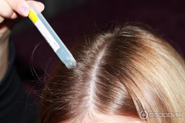 Как остановить выпадение волос никотиновая кислота
